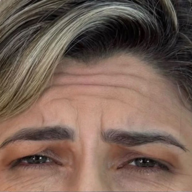 Resultado de paciente, antes do procedimento